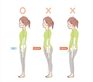 骨盤矯正